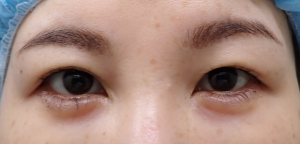 ひらた前 | 大山皮ふ科 形成外科