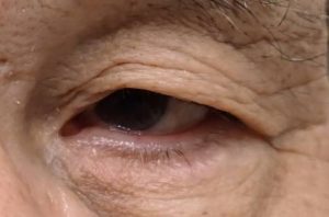 内田後正面 1 | 大山皮ふ科 形成外科