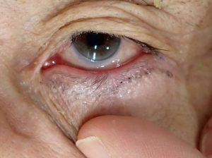 内田前2 2 | 大山皮ふ科 形成外科