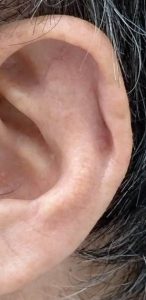 内田後2 1 | 大山皮ふ科 形成外科