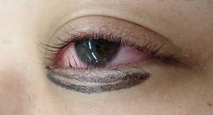 komazawa前 1 | 大山皮ふ科 形成外科