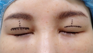 ひらた前2 | 大山皮ふ科 形成外科